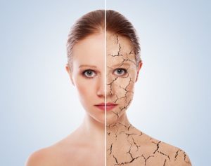 מתיחת פנים ללא ניתוח, מה חשוב לדעת